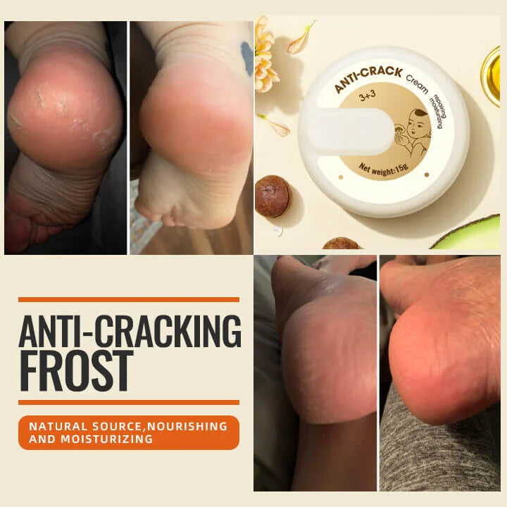AntiCracks™ - Fußcreme