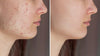 1+1 GRATIS | Putimi™ - Wirksamer Hautoptimierer